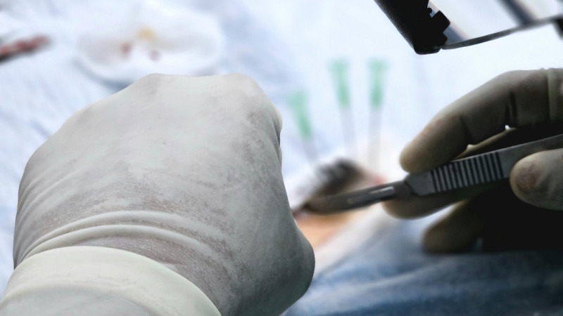 Balancing Health and Aesthetics: Expert Advice on Obesity and Plastic Surgery Choices from Dr. Sam Jejuikar and Co.